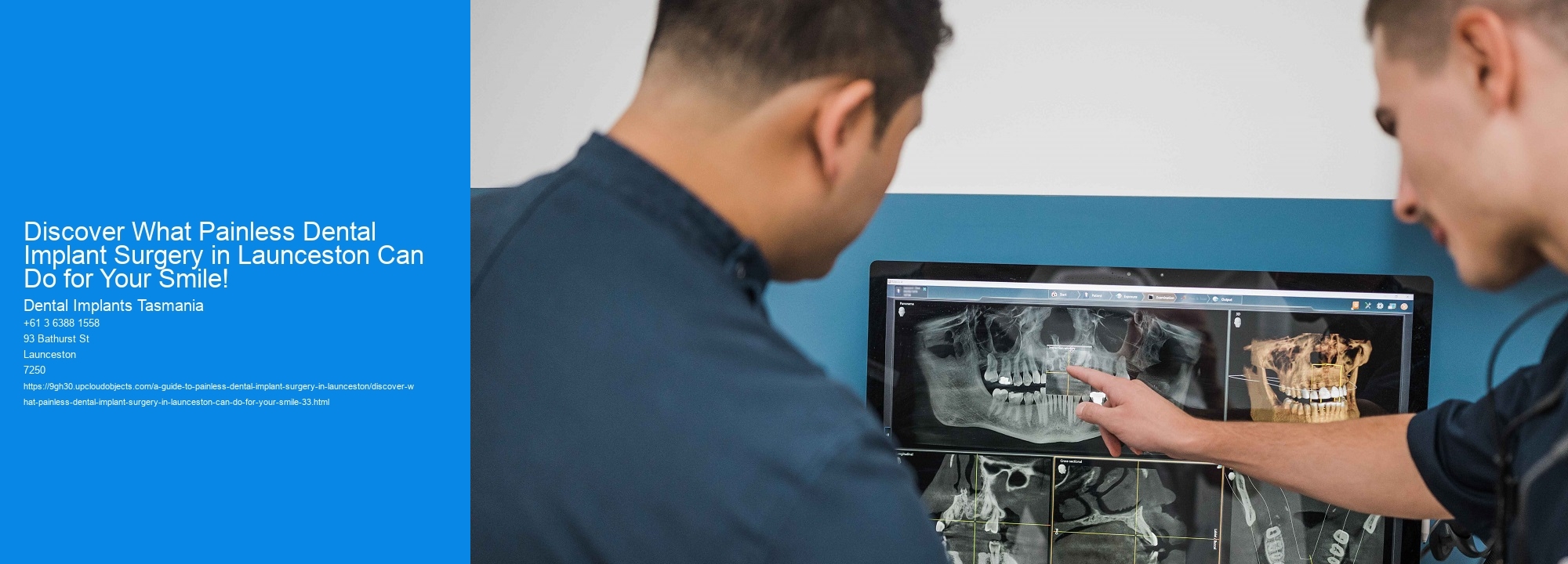 Discover What Painless Dental Implant Surgery in Launceston Can Do for Your Smile!