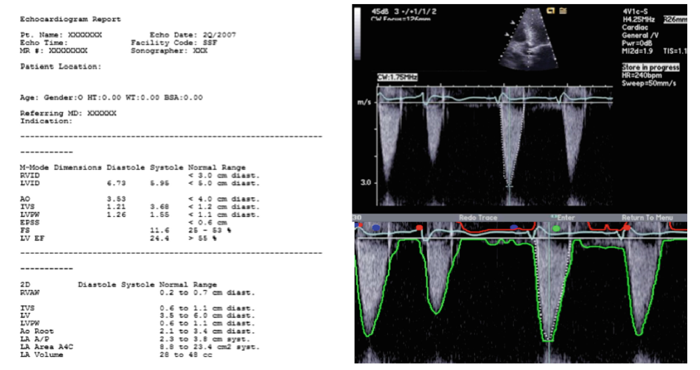 Medical Sieve Radiology Grand Challenge IBM